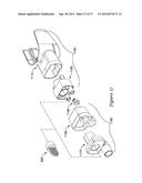 MEDICAL BREATHING APPARATUS diagram and image