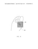 SYSTEM AND METHOD FOR DETECTING TISSUE STATE AND INFECTION DURING     ELECTROSURGICAL TREATMENT OF WOUND TISSUE diagram and image