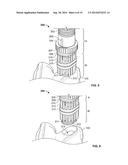 Graft Cartilage Management Systems and Methods diagram and image