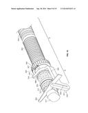 Graft Cartilage Management Systems and Methods diagram and image