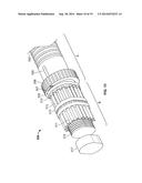 Graft Cartilage Management Systems and Methods diagram and image