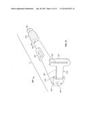 Graft Cartilage Management Systems and Methods diagram and image