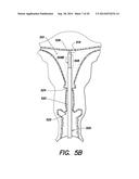 INTRAUTERINE MEASUREMENT DEVICE diagram and image