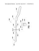 INTRAUTERINE MEASUREMENT DEVICE diagram and image