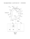 CRYOTHERAPY COMPRESSION SYSTEM diagram and image