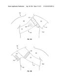 CRYOTHERAPY COMPRESSION SYSTEM diagram and image