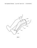 CRYOTHERAPY COMPRESSION SYSTEM diagram and image