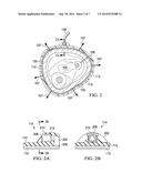 SYSTEM AND METHOD UTILIZING VACUUM FOR PROMOTING THE HEALING OF SPRAINS diagram and image