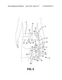 Strapping System for Securing an Orthopedic Brace to the Body diagram and image