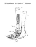 MODULAR SYSTEM FOR AN ORTHOPEDIC WALKING BOOT diagram and image