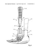 MODULAR SYSTEM FOR AN ORTHOPEDIC WALKING BOOT diagram and image