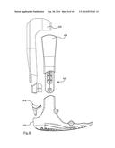 MODULAR SYSTEM FOR AN ORTHOPEDIC WALKING BOOT diagram and image