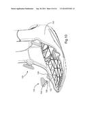 MODULAR SYSTEM FOR AN ORTHOPEDIC WALKING BOOT diagram and image