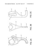 ORTHOSIS, SYSTEM AND METHODS FOR ADDRESSING FOOT DROP diagram and image