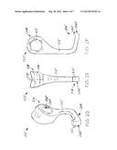 ORTHOSIS, SYSTEM AND METHODS FOR ADDRESSING FOOT DROP diagram and image