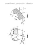 SYSTEM AND METHOD FOR TREATING LEG ULCERS diagram and image