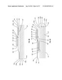 WOUND OR SKIN TREATMENT DEVICES WITH VARIABLE EDGE GEOMETRIES diagram and image