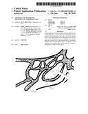 APPARATUS AND METHOD FOR TREATMENT OF ETHMOID SINUSITIS diagram and image