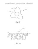 APPARATUS AND METHOD FOR TREATMENT OF ETHMOID SINUSITIS diagram and image