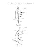 APPARATUS AND METHOD FOR TREATMENT OF ETHMOID SINUSITIS diagram and image