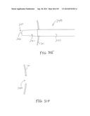 APPARATUS AND METHOD FOR TREATMENT OF ETHMOID SINUSITIS diagram and image