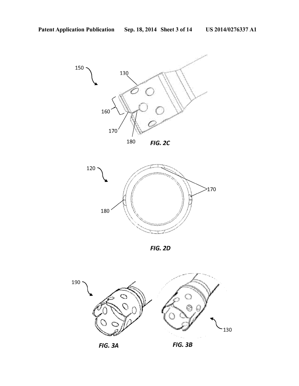 Implantable Devices with Delivery Systems and Methods for Blocking     Digestive Neurohormonal Pathways in Mammals - diagram, schematic, and image 04