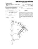 DEVICES, SYSTEMS AND METHODS FOR DIVERTING FLUID TRAPPED IN A SOLID ORGAN diagram and image