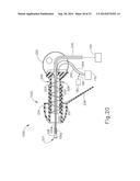 SYSTEM AND METHOD FOR PROVIDING IONTOPHORESIS AT TYMPANIC MEMBRANE diagram and image