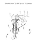 SYSTEM AND METHOD FOR PROVIDING IONTOPHORESIS AT TYMPANIC MEMBRANE diagram and image