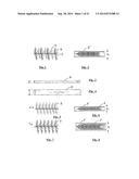 EMBOLIZATION SYSTEMS diagram and image