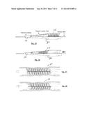 EMBOLIZATION SYSTEMS diagram and image