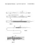 EMBOLIZATION SYSTEMS diagram and image