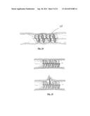 EMBOLIZATION SYSTEMS diagram and image