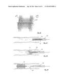 EMBOLIZATION SYSTEMS diagram and image