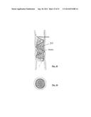 EMBOLIZATION SYSTEMS diagram and image