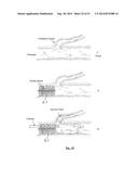 EMBOLIZATION SYSTEMS diagram and image