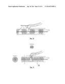 EMBOLIZATION SYSTEMS diagram and image