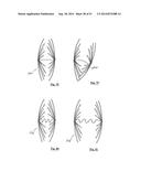 EMBOLIZATION SYSTEMS diagram and image