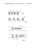 EMBOLIZATION SYSTEMS diagram and image