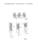 EMBOLIZATION SYSTEMS diagram and image