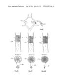 EMBOLIZATION SYSTEMS diagram and image