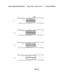 EMBOLIZATION SYSTEMS diagram and image