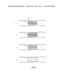 EMBOLIZATION SYSTEMS diagram and image