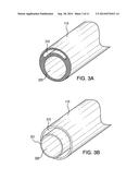 CATHETER HAVING MOVABLE TUBULAR STRUCTURE diagram and image