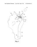 Socketed Portal Anchors and Methods of Using Same diagram and image