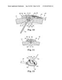 Socketed Portal Anchors and Methods of Using Same diagram and image