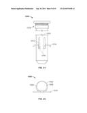 Anchor Device and Method diagram and image