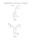 Anchor Device and Method diagram and image