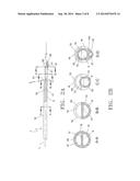 Dialysis Catheters with Fluoropolymer Additives diagram and image