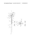 Dialysis Catheters with Fluoropolymer Additives diagram and image